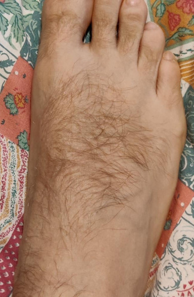 PP - Hairy Feet