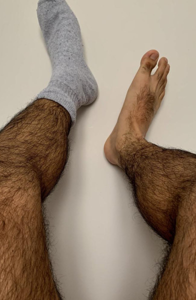 My Hairy Legs