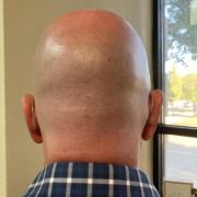 Baldguy